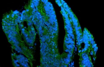 Claudin 7 Antibody / CLDN7