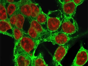 Glypican 3 Antibody / GPC3