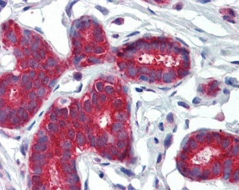 PTCH1 Antibody