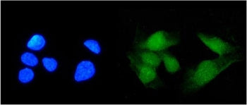 TRIM21 Antibody / SS-A