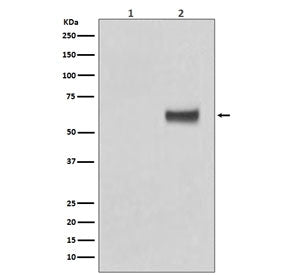 Estrogen Receptor alpha Antibody (pS118)