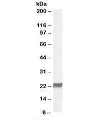 SM22 alpha Antibody