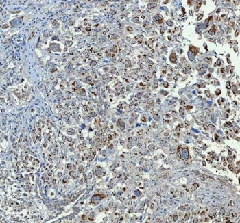 CHGA Antibody / Chromogranin A