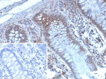 EZH2 Antibody