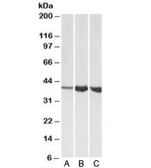 Aldolase A Antibody