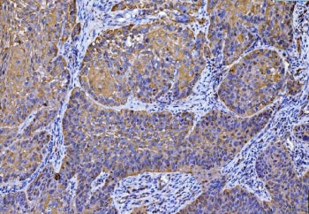 SLC25A51/52 Antibody / MCART1/2