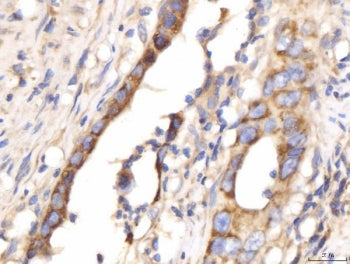 Myomegalin Antibody / PDE4DIP