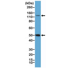 NFKB1 Antibody