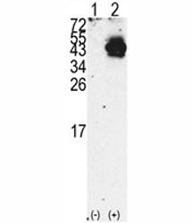 PDX1 Antibody