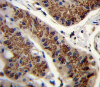 Inhibin beta A chain Antibody / INHBA