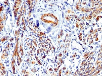 Caldesmon / CAD Antibody HMW