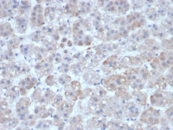IL1 beta Antibody / IL1B