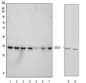 Western blot testing of 1) human A431, 2) human Jurkat, 3) human HepG2, 4) human PC-3, 5) human U-2