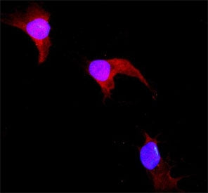 GST pi Antibody / GSTP1