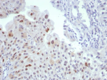 MDM2 Antibody