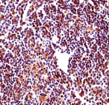 RBM22 Antibody