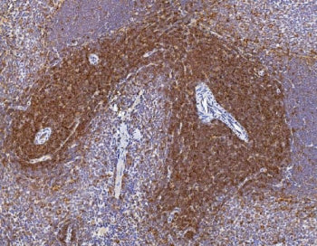 IHC staining of FFPE rat spleen with Cd2 antibody. HIER: boil tissue sections in pH8 EDTA for 20 min
