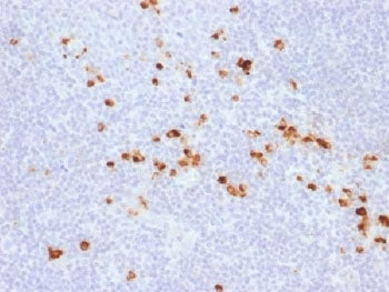 IHC testing of FFPE human tonsil with recombinant IgG antibody (clone IG507R). HIER: steam sections