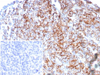 CD35 Antibody / CR1