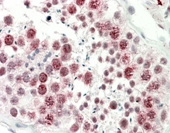 DNAJC5G Antibody