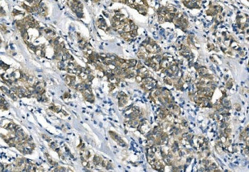ASS1 Antibody / Argininosuccinate synthetase 1
