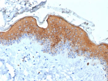 IHC staining of FFPE human skin tissue with recombinant KRT10 antibody (clone rKRT10/6923). HIER: bo