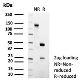 CD23 Antibody