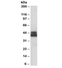 HLA-B Antibody
