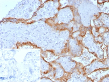 IHC staining of FFPE human placental tissue with HCG-alpha antibody (clone hCGa/7872). Inset: PBS us
