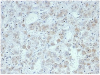 Recombinant IL15 Antibody / Interleukin 15