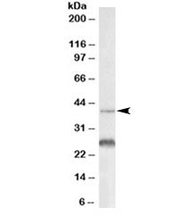 Cxcr2 Antibody