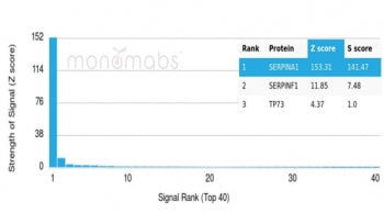 Alpha 1 Antitrypsin Antibody / AAT / SERPINA1
