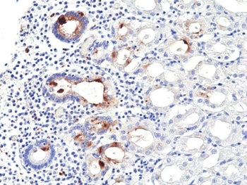 Helicobacter pylori Antibody