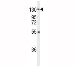 FGFR1 Antibody