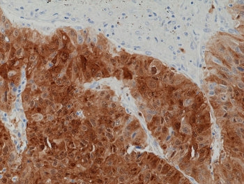 Recombinant Arginase 1 Antibody