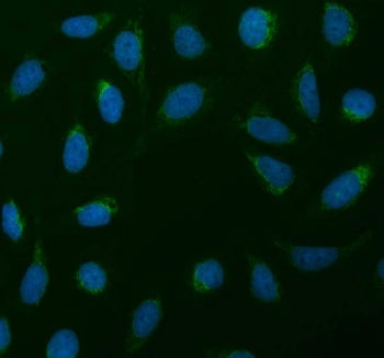 SDHA Antibody