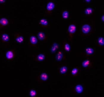 Immunofluorescent staining of RSL24D1 using anti-RSL24D1 antibody (red). RSL24D1 was detected in an