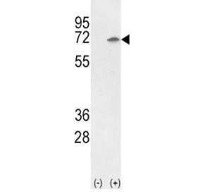 Western blot analysis of Ku70 antibody and 293 cell lysate (2 ug/lane) either nontransfected (Lane 1
