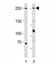 Western blot analysis of lysate from 1) HeLa and 2) MCF-7 cell line using MUC4 antibody; Ab was dilu