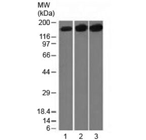 Topoisomerase II alpha Antibody / TOP2A
