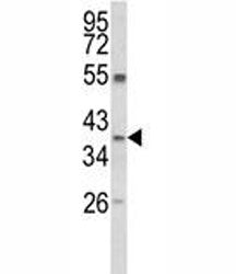 ARG1 Antibody