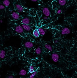 GFAP Antibody / Glial Fibrillary Acidic Protein
