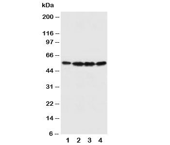Fascin Antibody