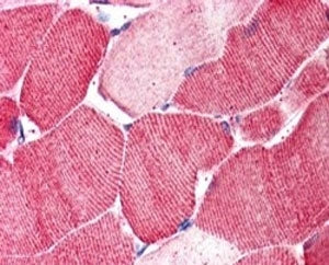 IHC staining of FFPE human skeletal muscle with ARSB antibody at 5ug/ml. HIER: steamed with pH6 citrate buffer, AP-staining.