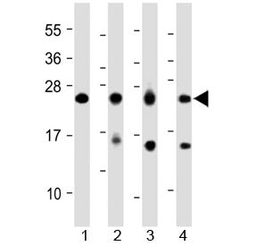 MYL1 Antibody (Center Region)