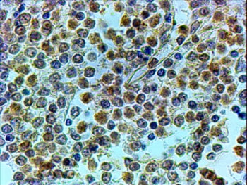TRIP Antibody