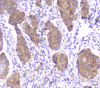 SMN1/2 Antibody