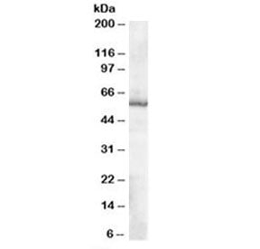 Western blot testing of human placenta lysate with TXNRD1 antibody at 0.1ug/ml. Predicted molecular