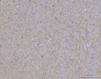 WDR7 Antibody / WD repeat-containing protein 7