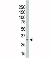 AURKC Antibody